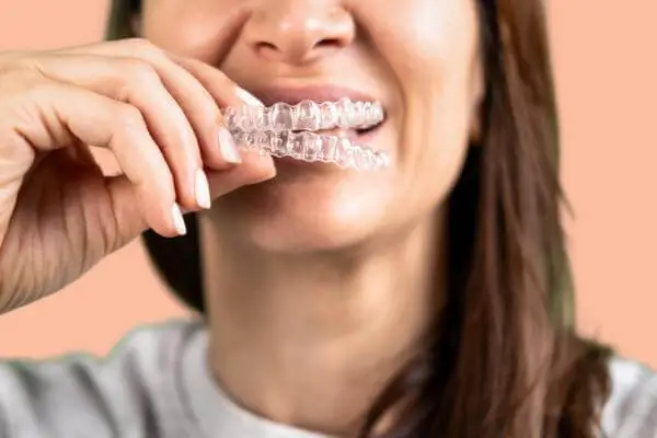 orthodontics-and-Invisalign-dentist-in-DTLA-image